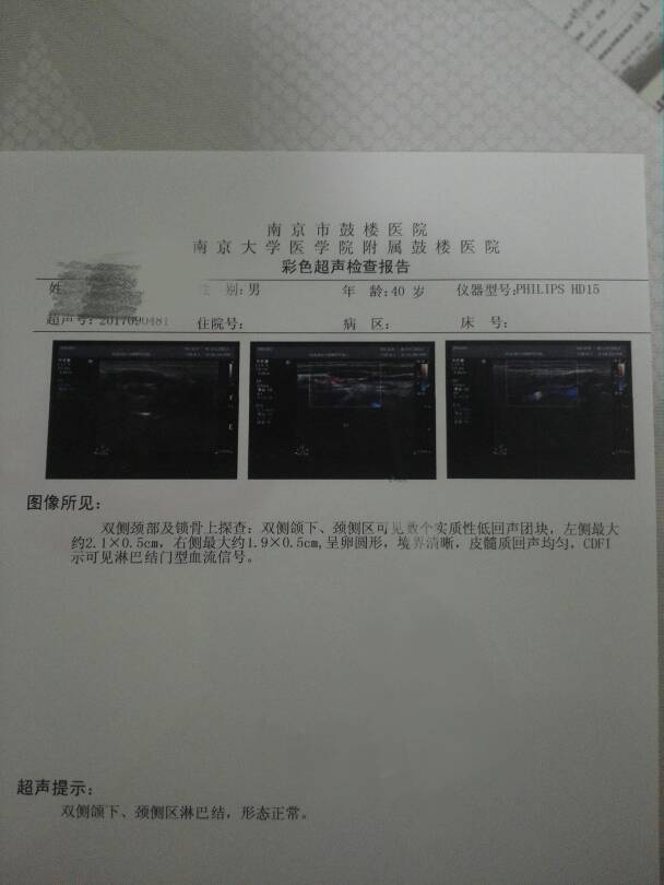 224504kiqt5ms5drjs5dfs.jpg