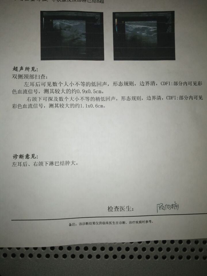 看我这是B超正常吗？