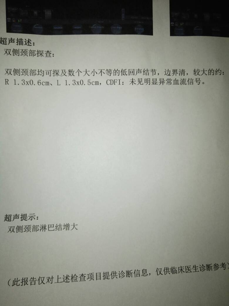 211655iao9rrb5be4f4vbt.jpg