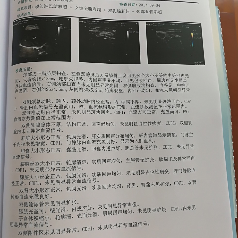 202627npmqtm8lz1mzptol.jpg
