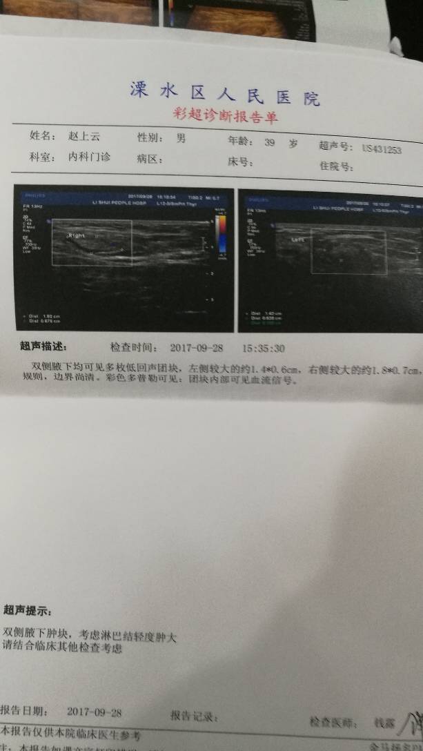 103239yjy5aq11y83ra66s.jpg