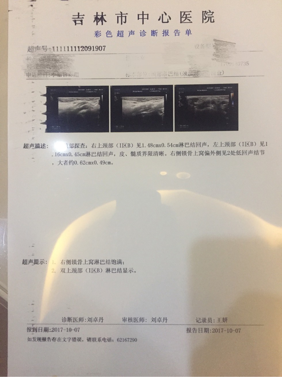 200533elpsxxigrsnrrcxr.jpg