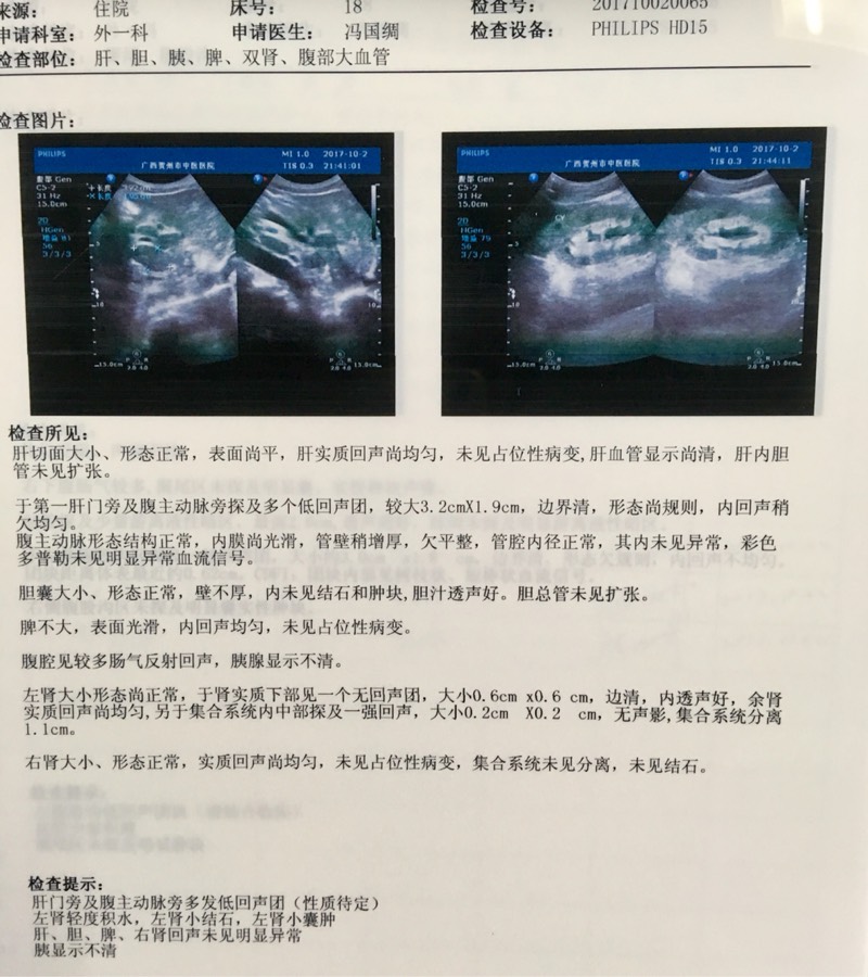 224053hzbdtbex7vyp7aiu.jpg