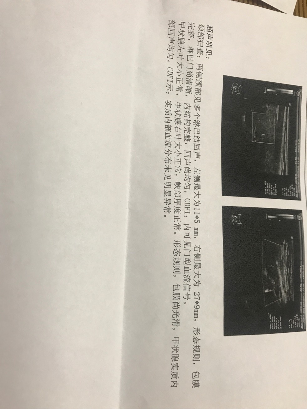 214627bj75o39bac1y7qbl.jpg