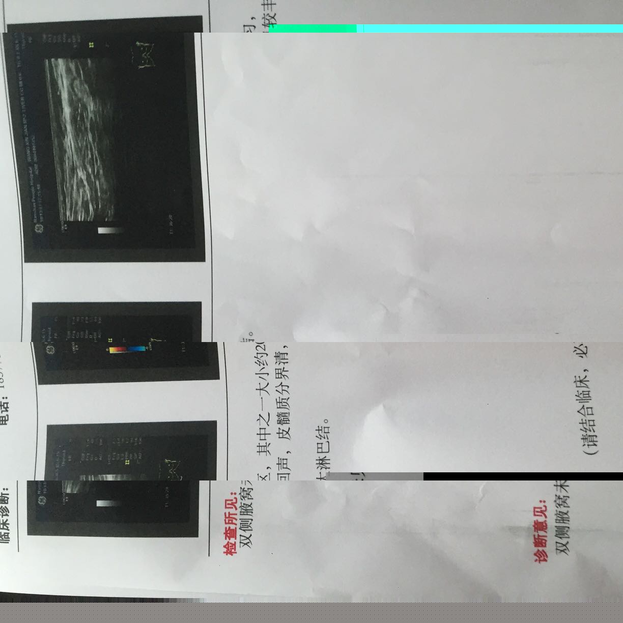 180611u9tagssyrgsxyepe.jpg