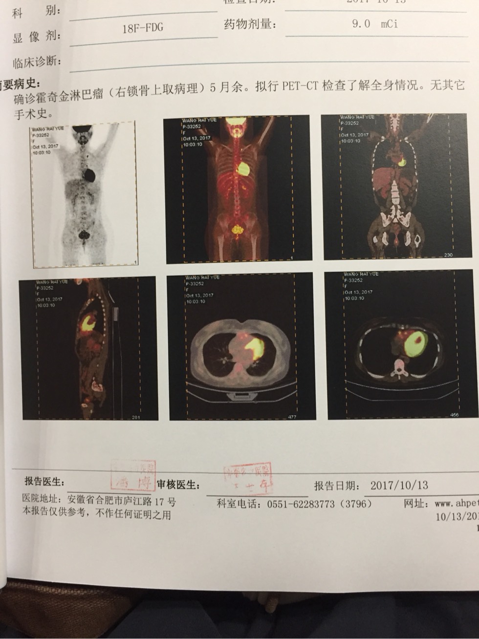 093304t8amtrc5kdi578aq.jpg