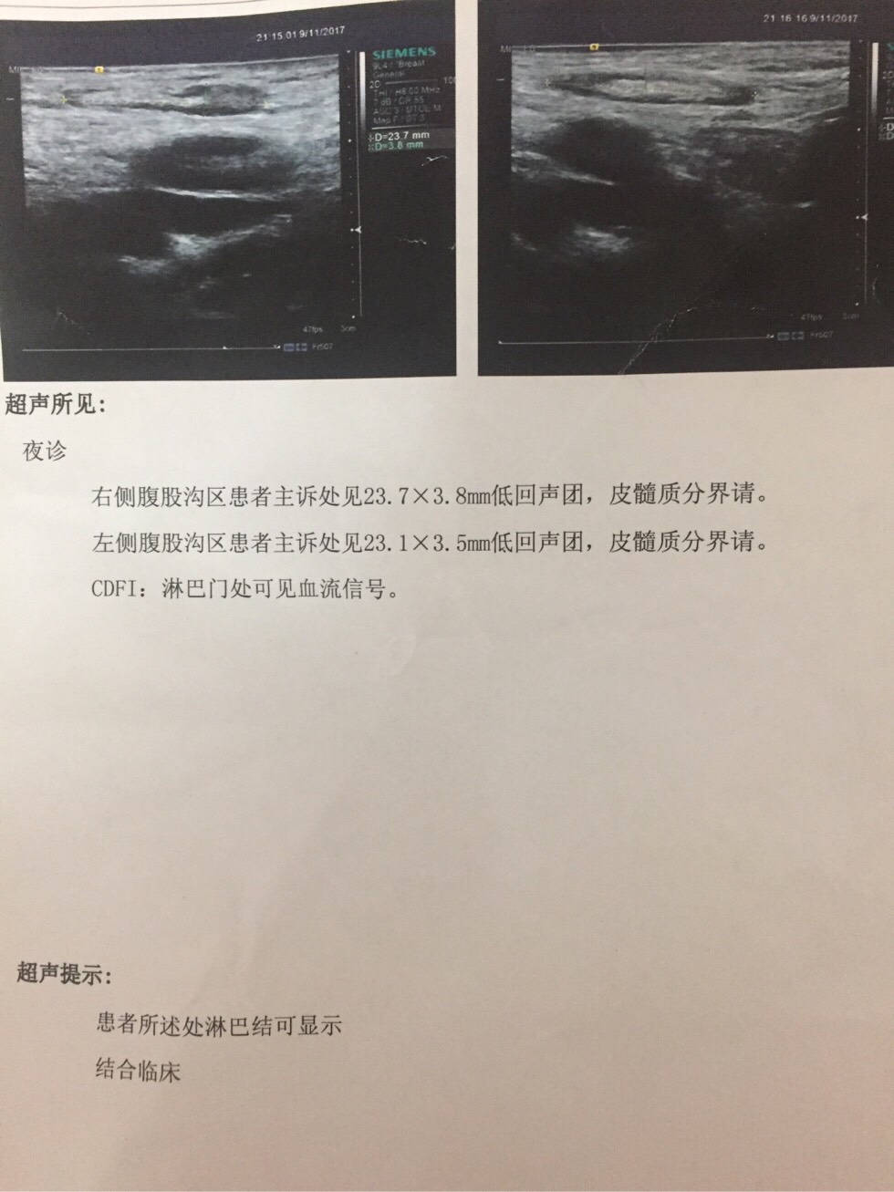 103454togzuy34ngy4oyvy.jpg