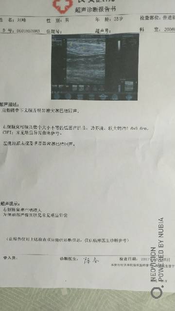 214218xwu2azbrs4zvnwmr.jpg