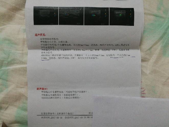 140736kc5hhk7io75cl87i.jpg