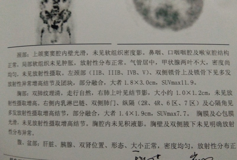 170917kwxcpqeesmlqqgp6.jpg