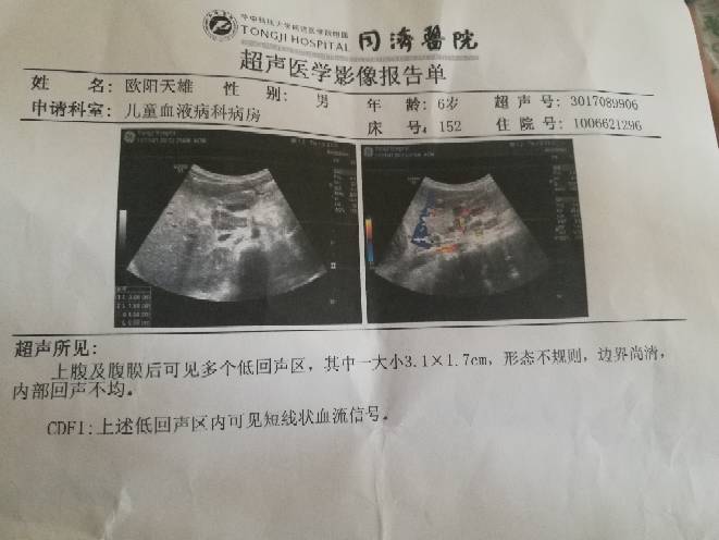 141340sdmxhxggymsj6sph.jpg