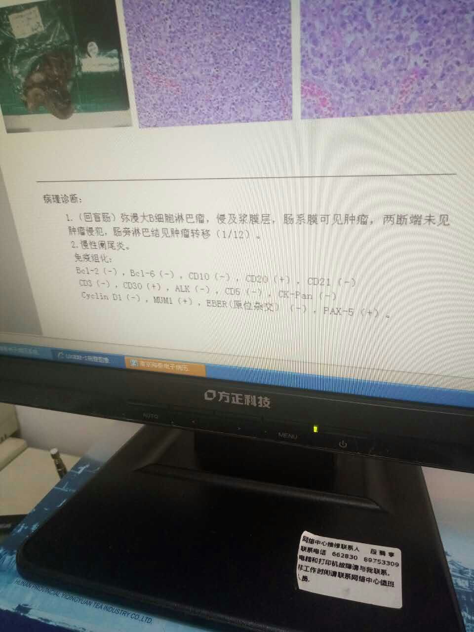 医生电脑上拍到的
