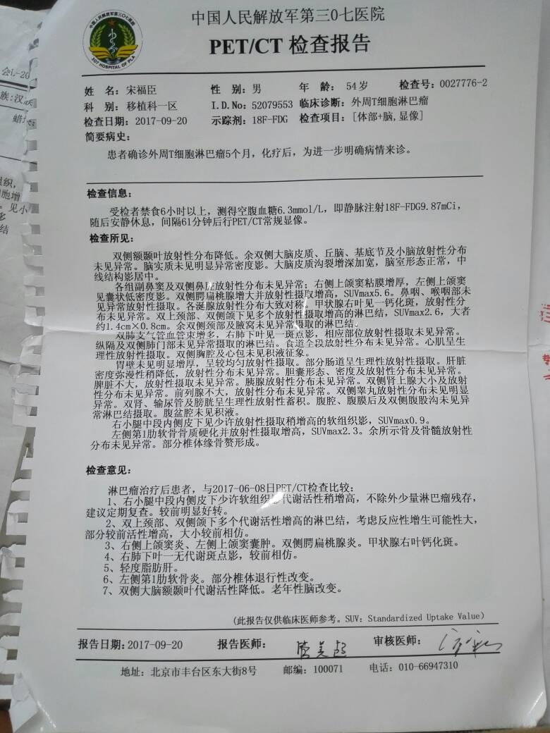 101239es9lnmgvn9zmtoom.jpg