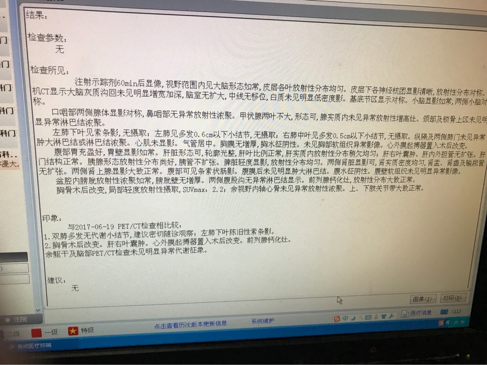 093605bprtdrp33tg2pdr1.jpg