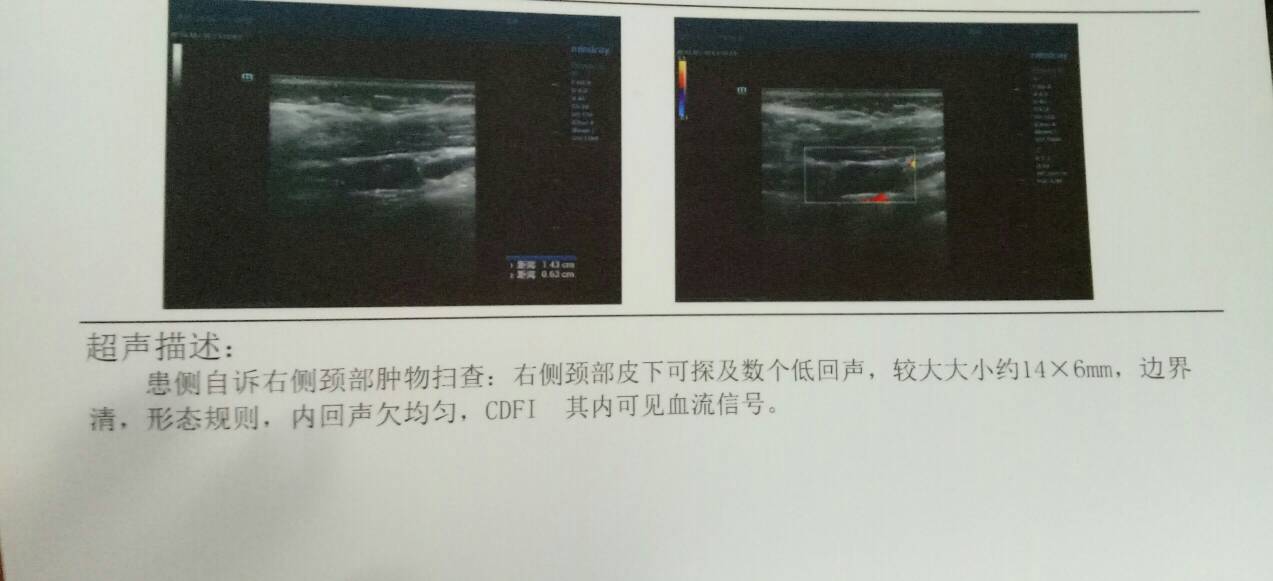 150037xb9940u4lpp19ubs.jpg