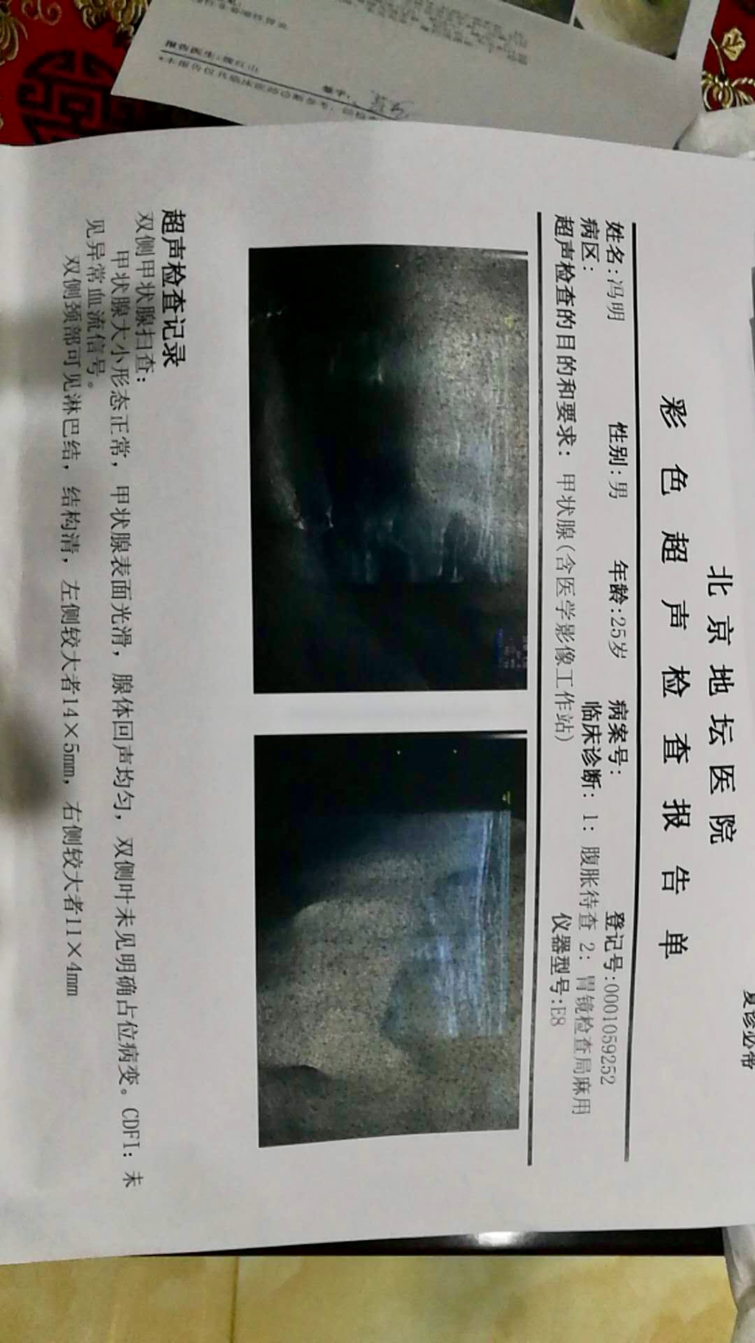 184353uyqe7828qey6eq87.jpg