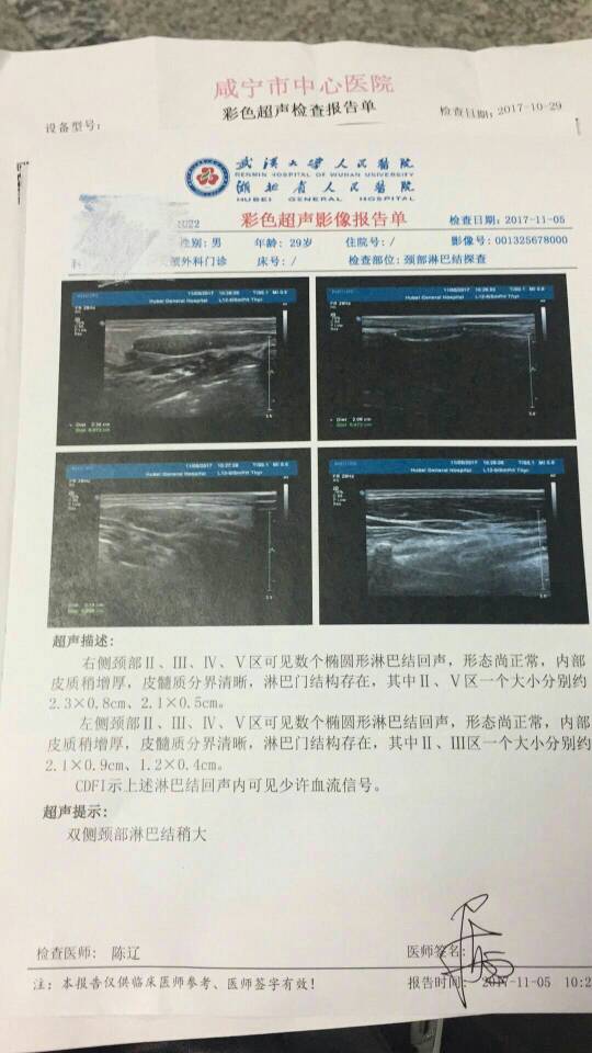 154609sfs8le9hs1hj9irf.jpg