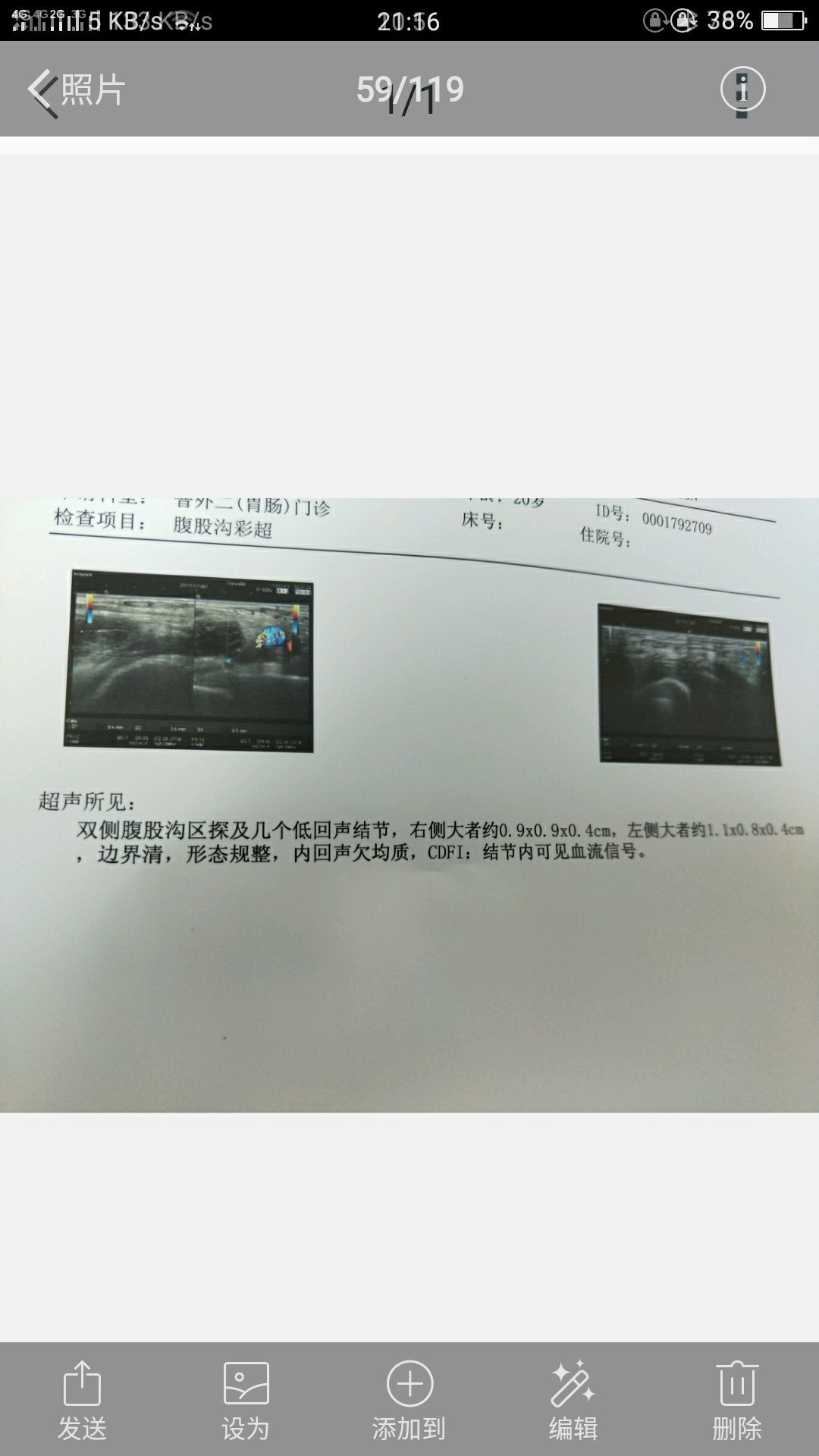 065149tkrir430by895yb0.png