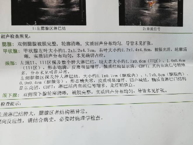 140310ubgz35b1nb6v66pr.jpg