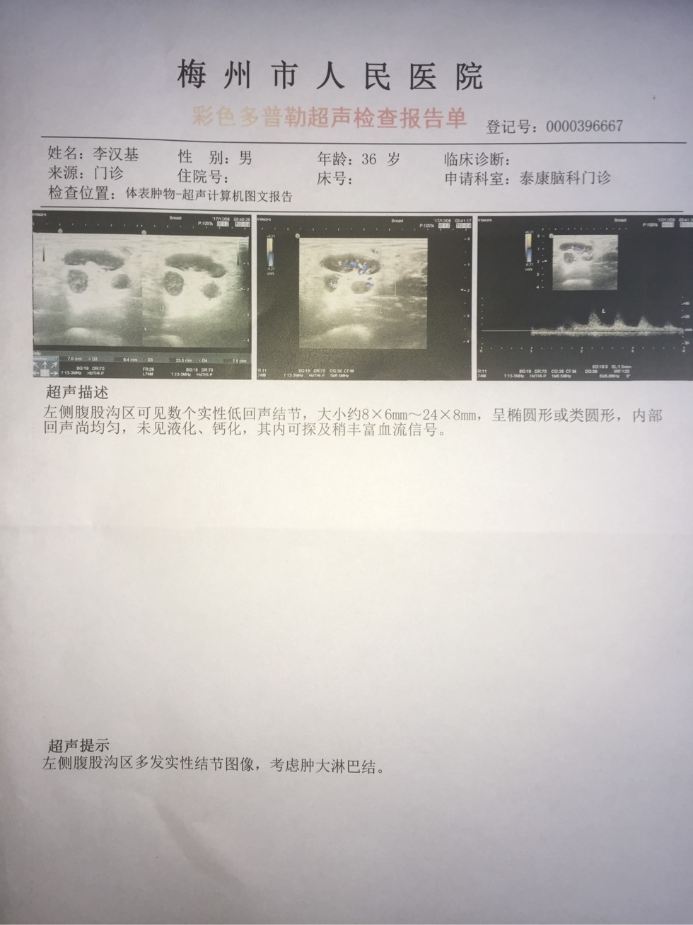 111849ycsyccbteqoc5atb.jpg