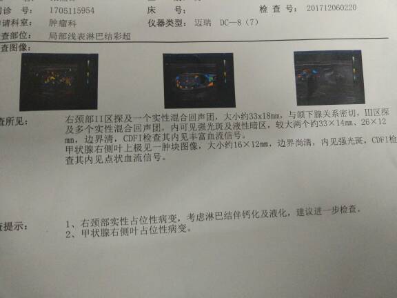 211219ihav1kca2m2cfhww.jpg