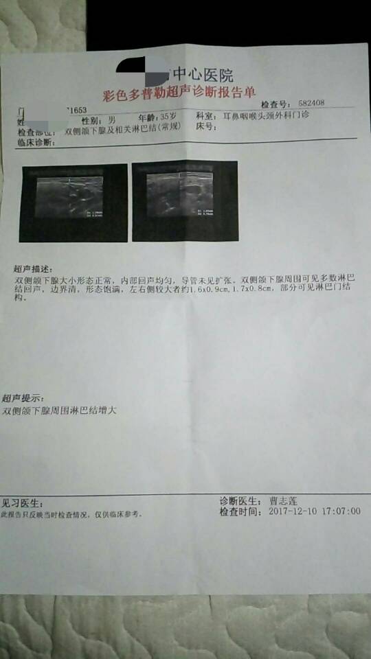 021847mzfnfqz5kscctqcf.jpg