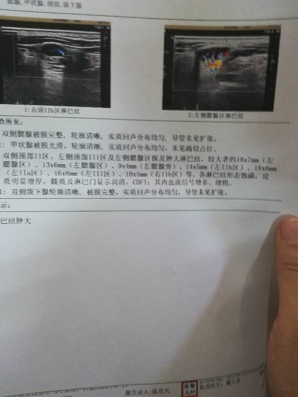141308n2ucncu3g5iu3322.jpg