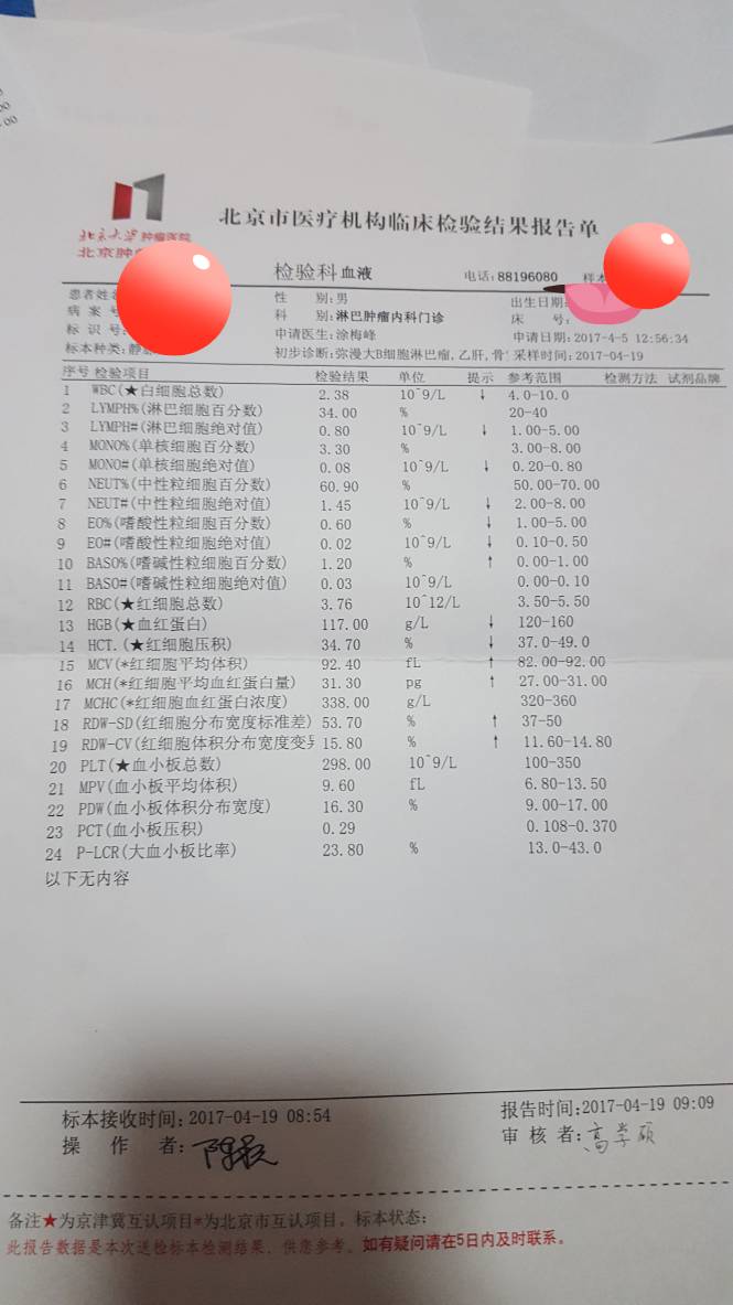 170311wtlnz5w0n10n51bb.jpg