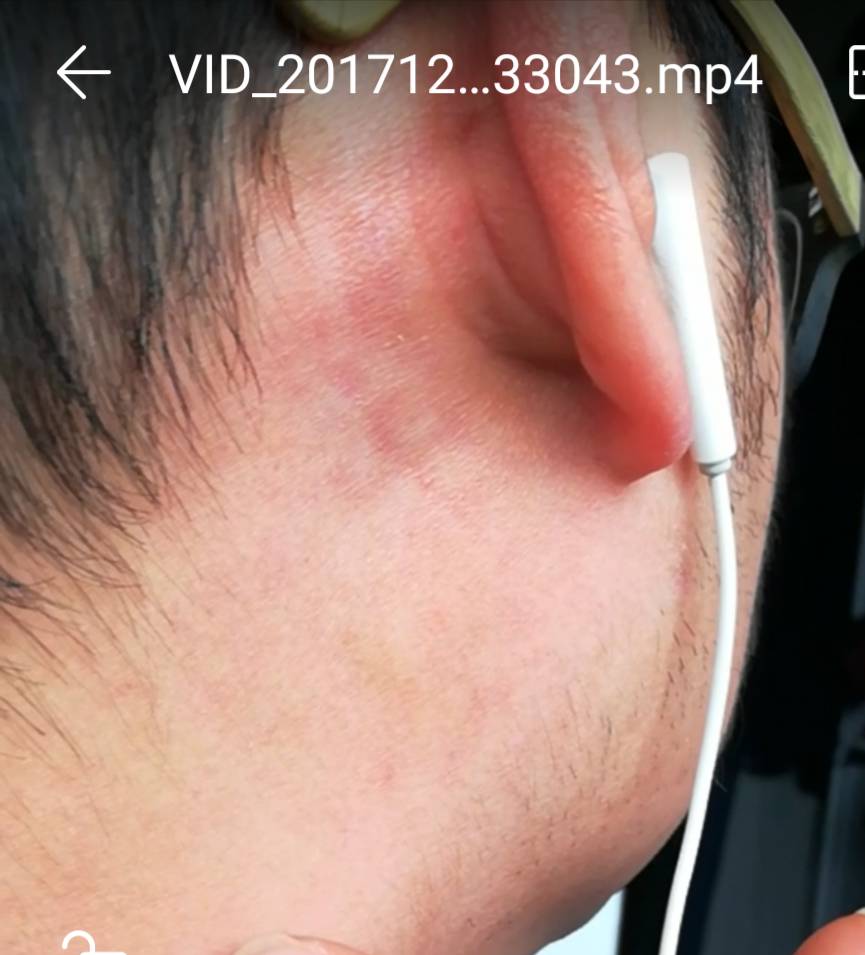 112031j5um56htg1m1695u.png