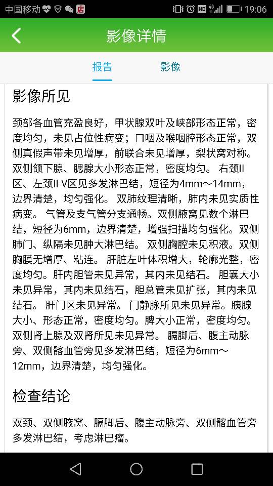 190847tdo6z60exbzdogwp.png