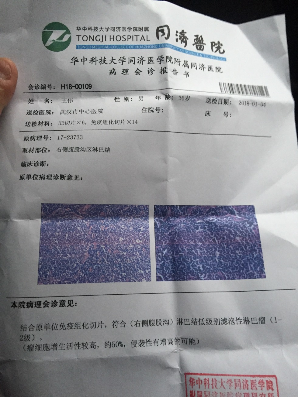 160634jc8c9zl98o8c9582.jpg