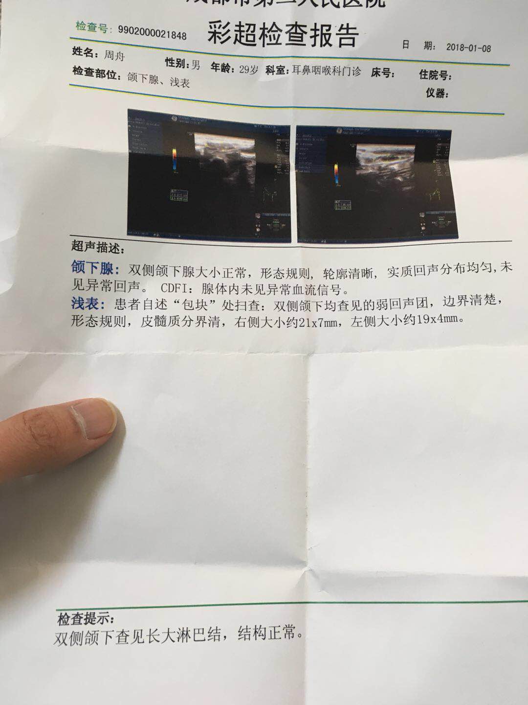 微信图片_20180108183602.jpg
