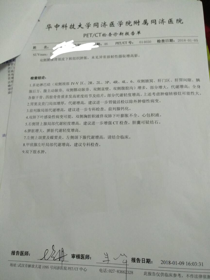 232039y86tc4ka85etbbhh.jpg