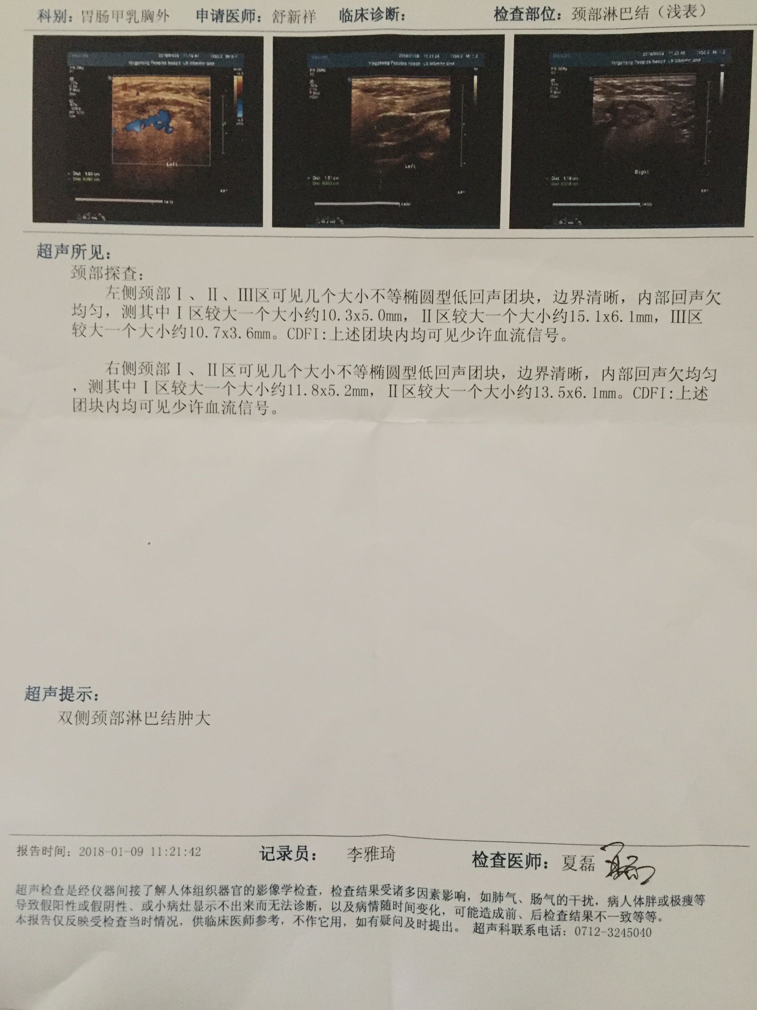 淋巴继续增大，求教