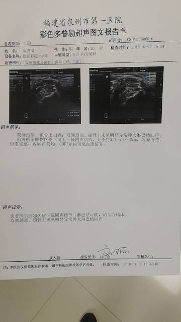 174806gaih2nb6tsbjjznj.jpg