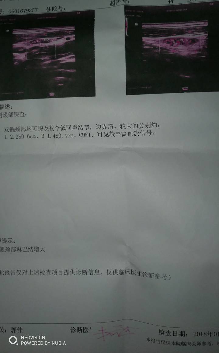 175743ftj5ikh2de325did.jpg