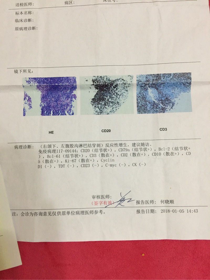 171744k3f72od15a45bdpf.jpg