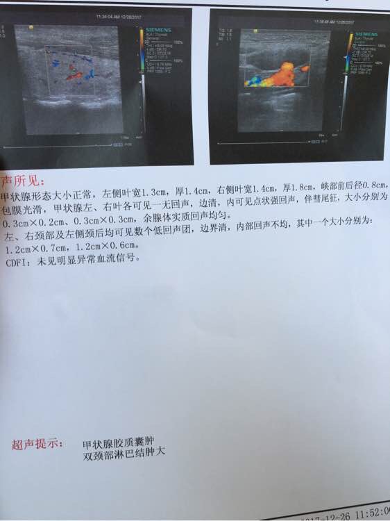 203640cig0ri2te14471dz.jpg