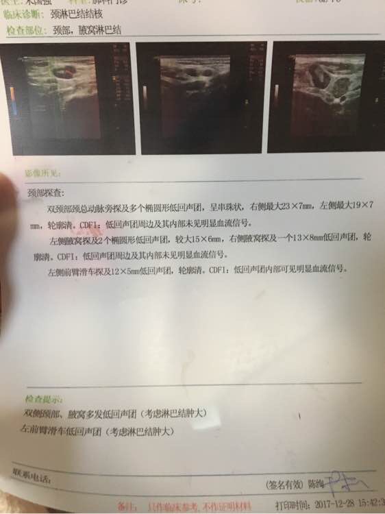 203641etfowhzykc13bfdc.jpg