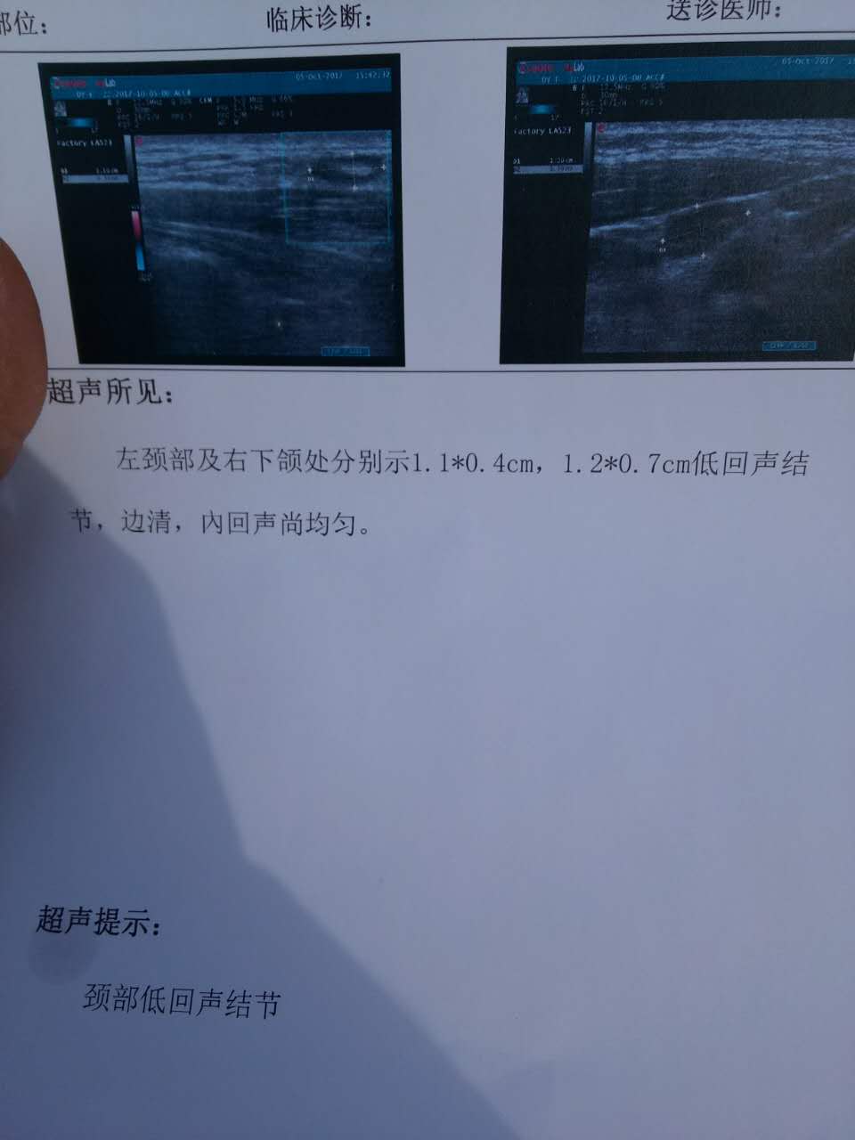 172543m67dtwweut7e6287.jpg