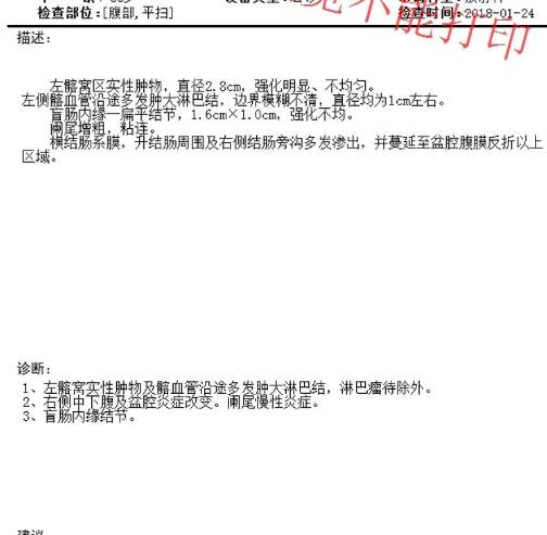 130048nmpujkoundupmdzu.png