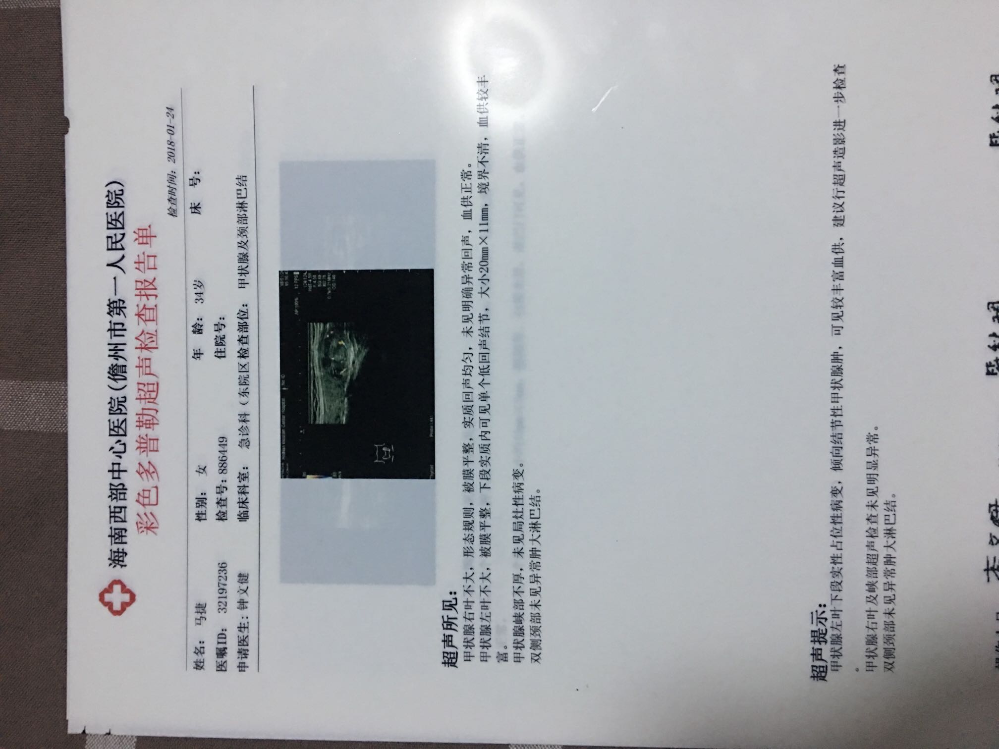 145124msxws12qwb3ehwx1.jpeg