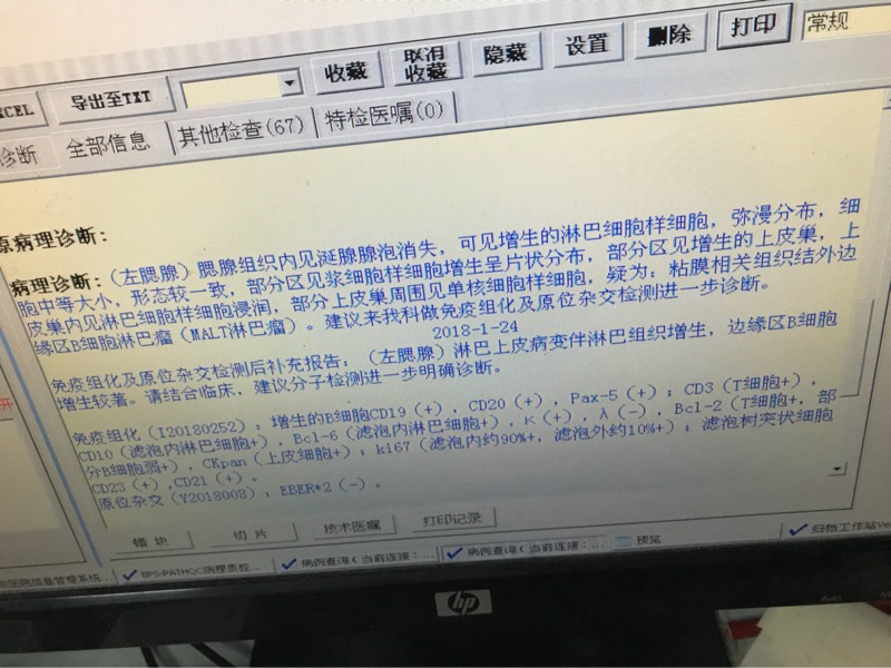 163615dq8o62fqnx6hgxir.jpg