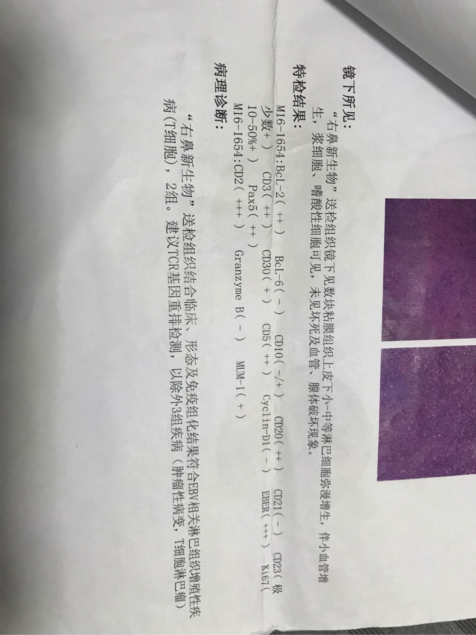 134909s0q4qwpuid0qdkqh.jpg
