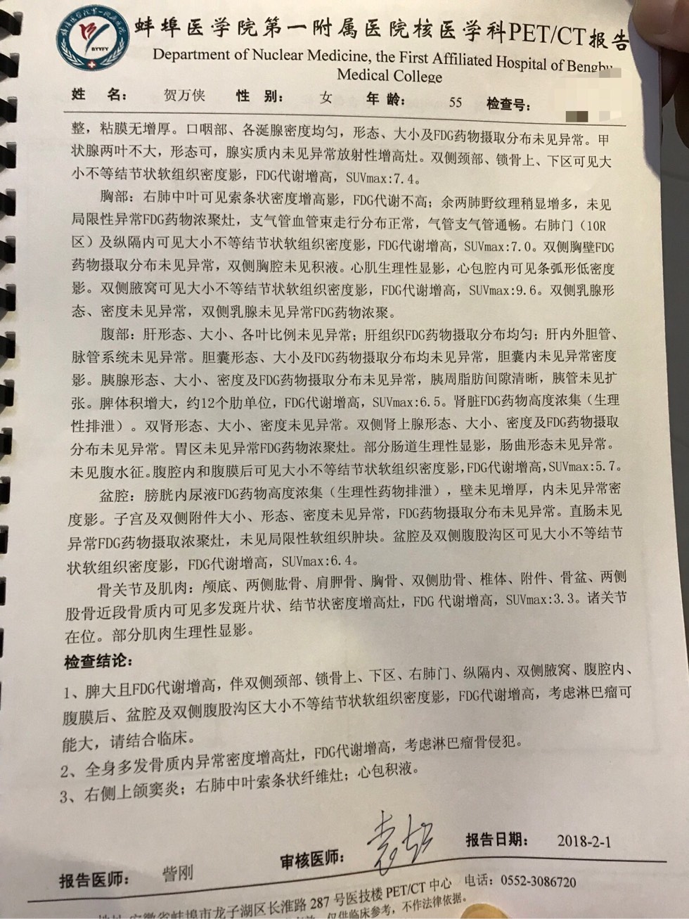 182748rp2rbaarsaloplcb.jpg