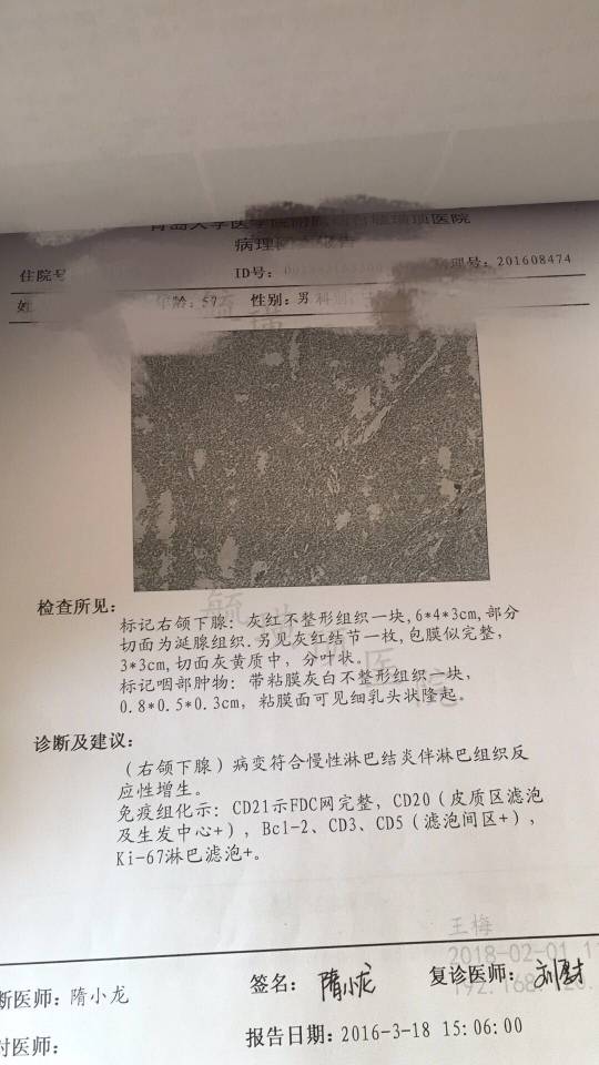 201801mvmcq4889px6cvzb.jpg
