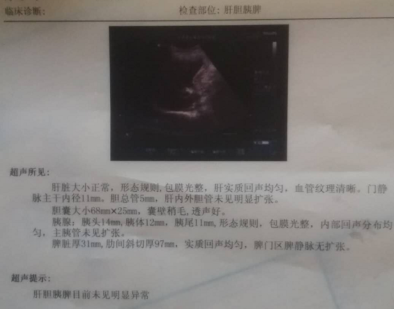 QQ截图20180203231244.png