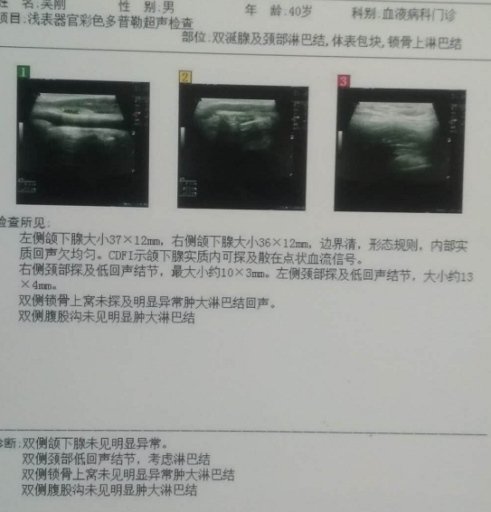 QQ截图20180203231225.png