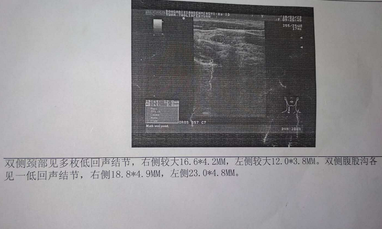 QQ截图20180203231257.png