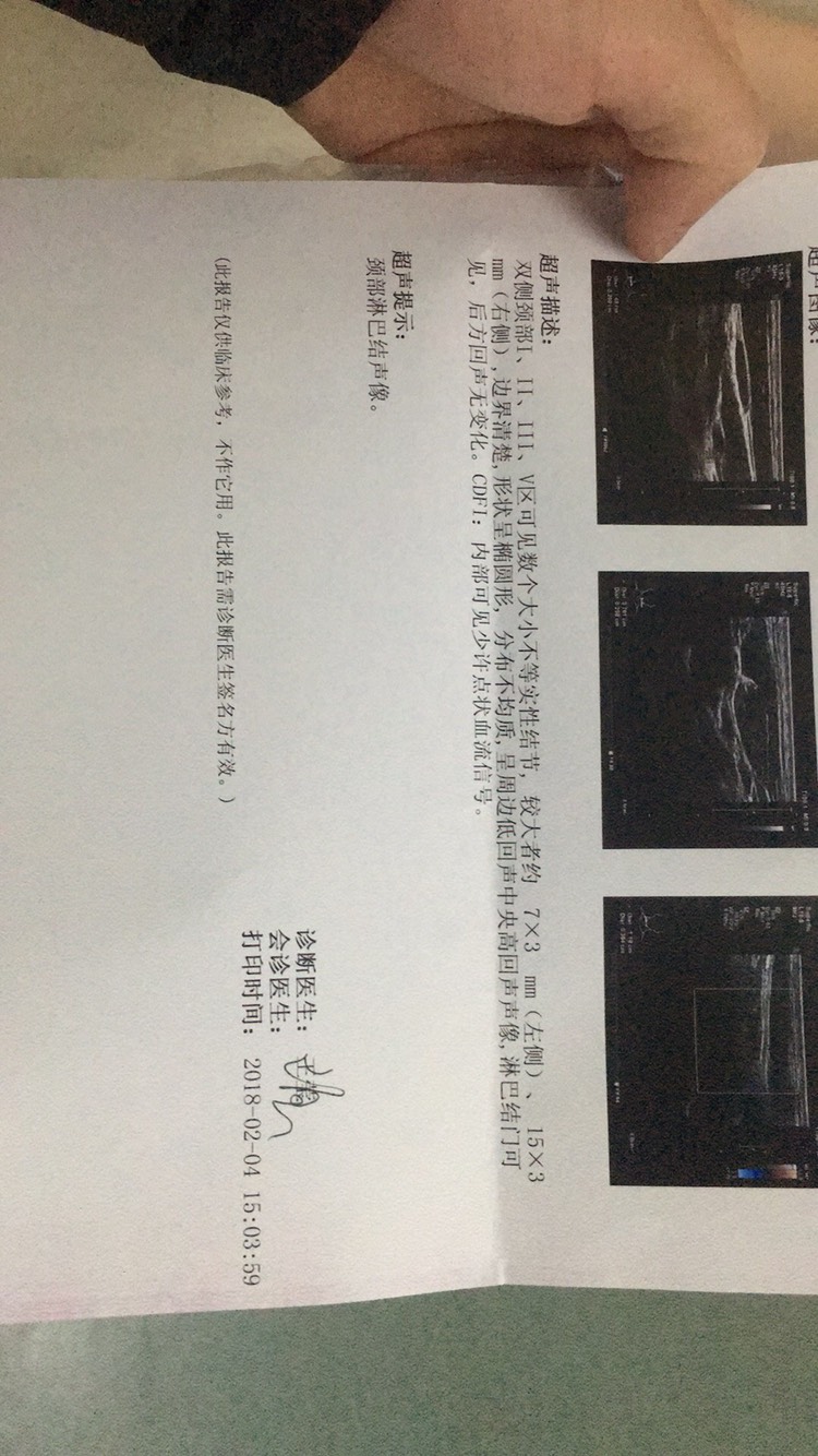 082318mmexbe6imsvgezwg.jpg